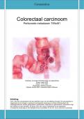 Casusanalyse colorectaal carcinoom oncologie vervolgopleiding EMC uit 2022 voldoende afgerond met patronen van Gordon, verpleegproblemen, 