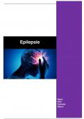 presentatie epilepsie
