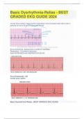 Basic Dysrhythmia-Relias - BEST GRADED EKG GUIDE 2024