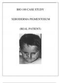 BIO 188 XERODERMA PIGMENTOSUM CASE STUDY REVIEW ( REAL PATIENT)