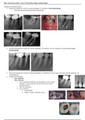 3.2 College uitwerking endodontologie h11, h18, h19
