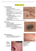 Samevatting verschillende soorten huidkanker Benigne, premaligne en maligne tumoren