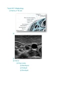 Thyroid Anatomy and Physiology Ultrasound