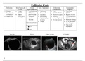 Ovarian Pathology - Ultrasound