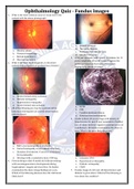 Ophtha Quiz - Fundus Images.